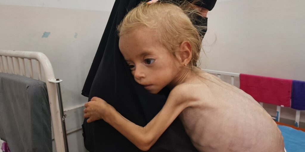 gazzede acliktan olmek siradanlasti BBBguDy1