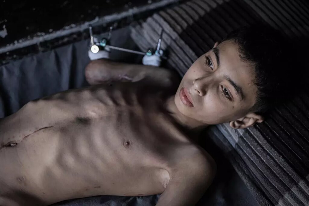 semirin umudu yeniden hayata donmek DUd152DE